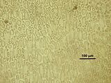 3 – Cellule corticali in visione superficiale